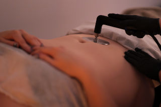 Brzuch po ciąży INDIBA